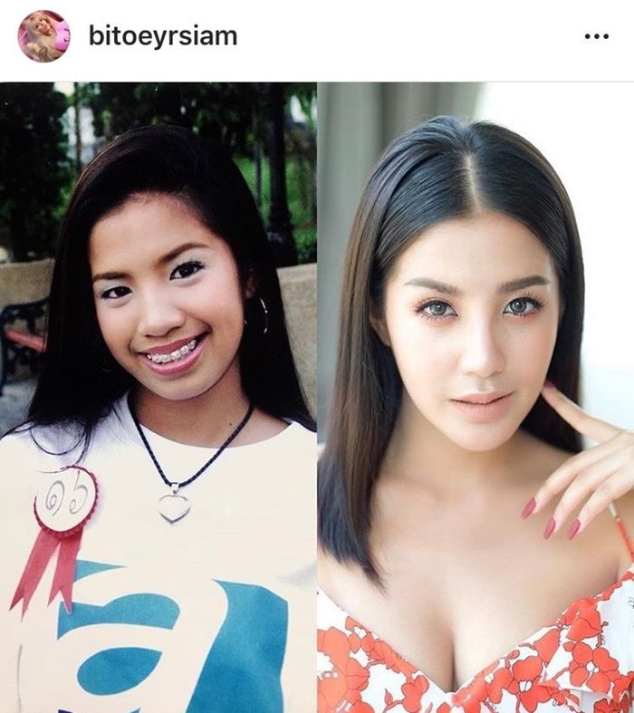ใบเตย โพสต์เทียบหน้าเก่า-หน้าใหม่