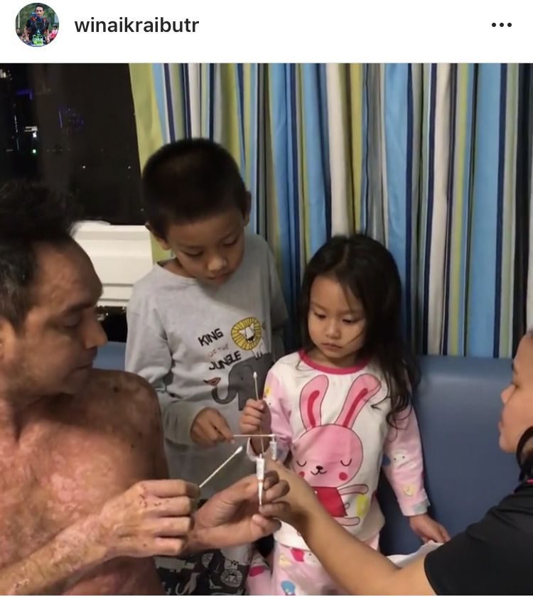 ลูกๆ ช่วยทายาให้ เมฆ วินัย