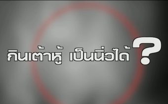 เจอนิ่วกว่า 400 ก้อนในไตคนไข้เพราะกินเต้าหู้มาก