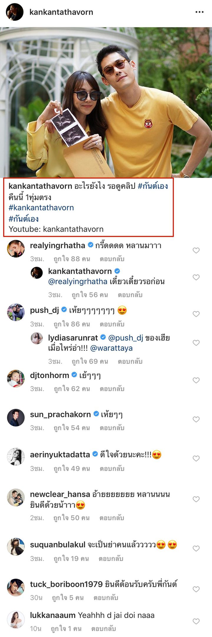 ไอจี กันต์ กันตถาวร